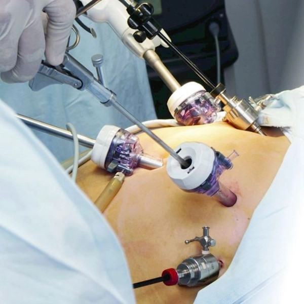 All-Gastric-Surgeries