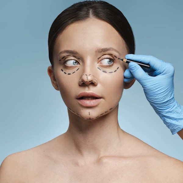 Blepharoplasty
