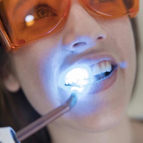 LED-Lazer-Teeth-Whitening